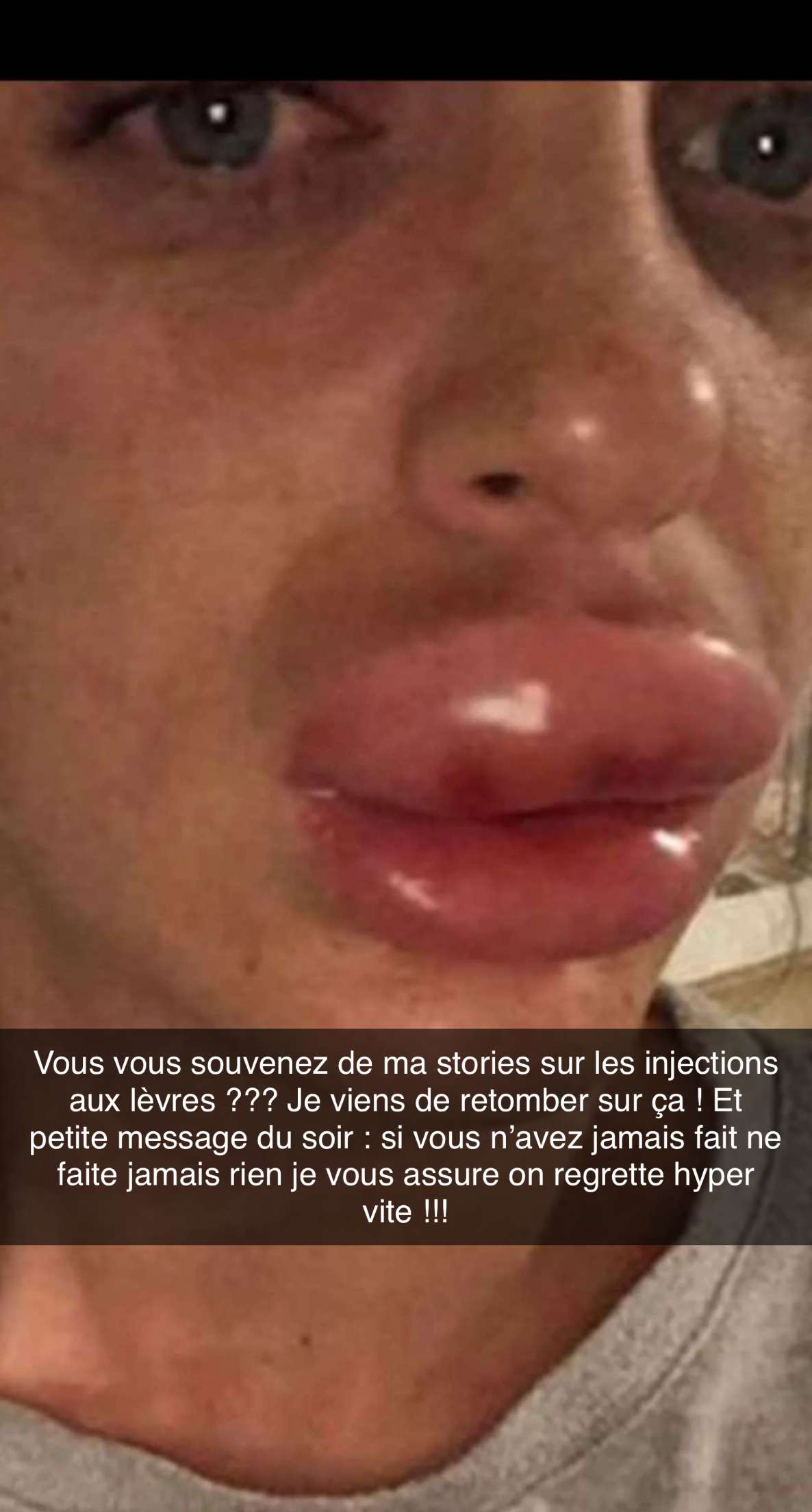 Story