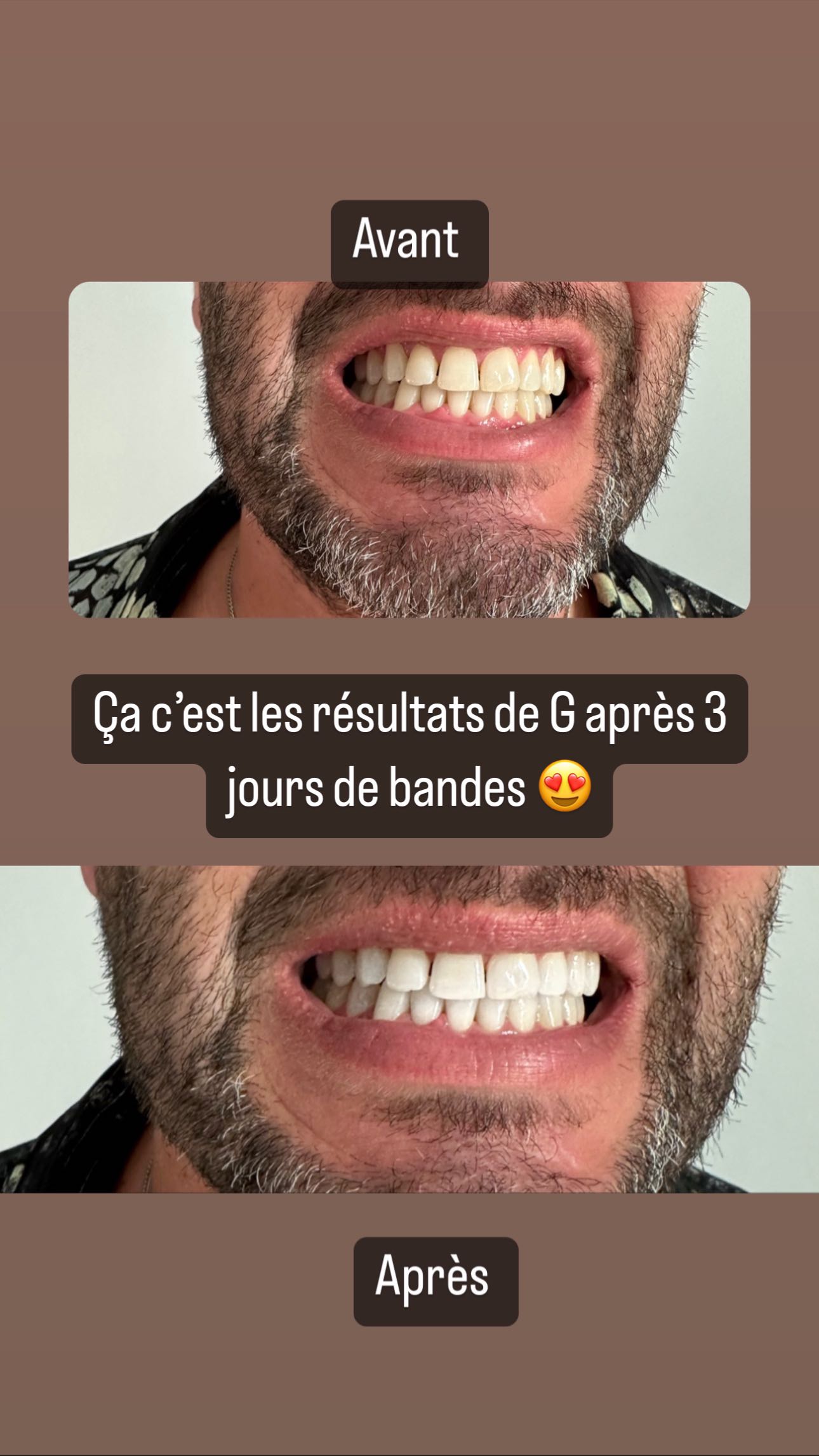 Story