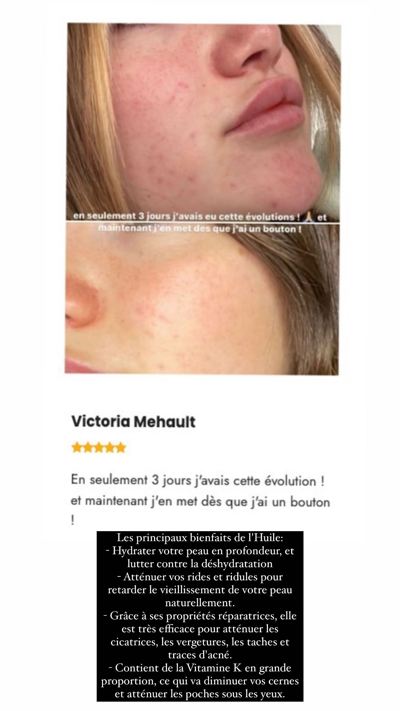 Story