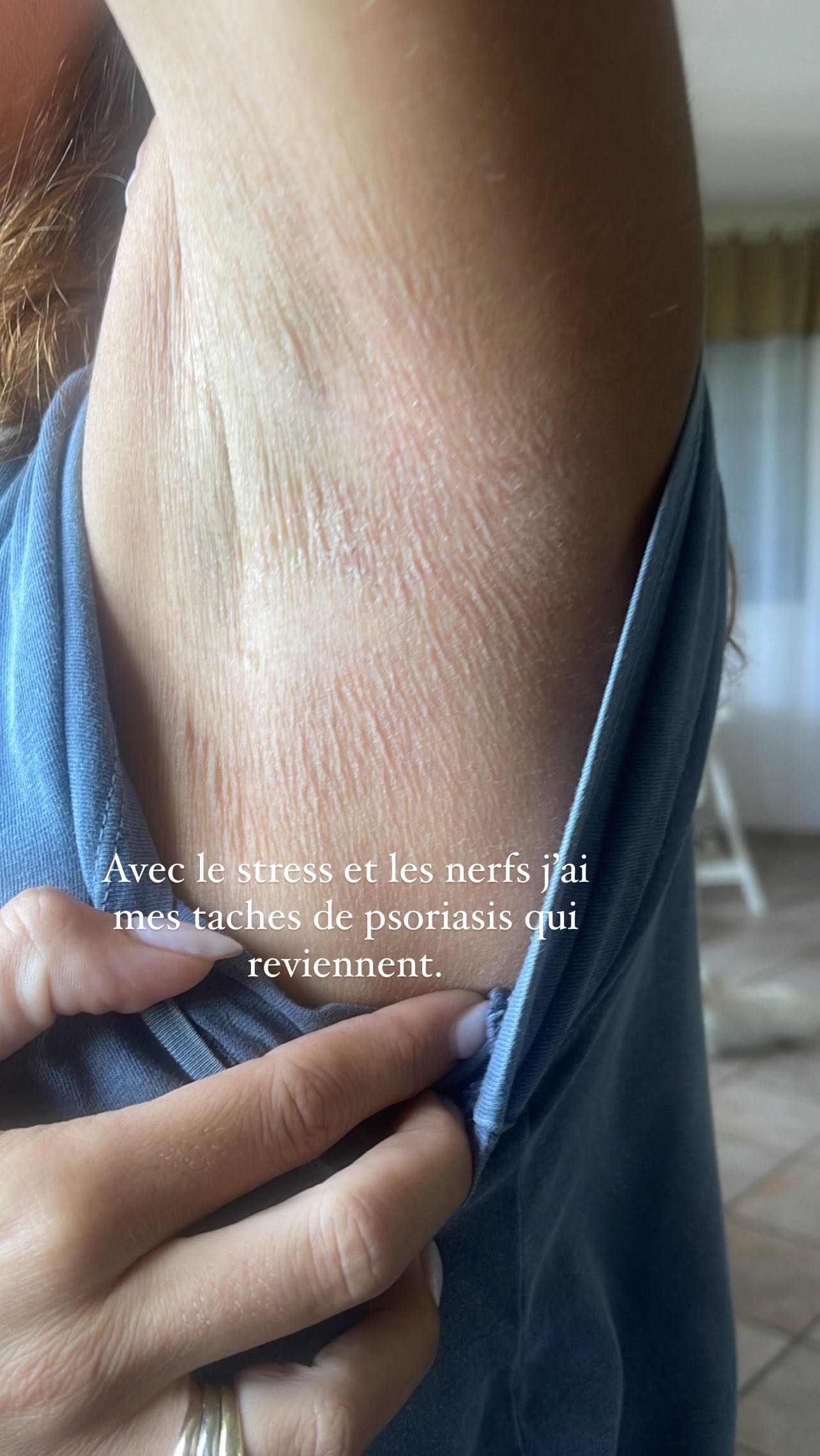 Story
