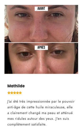Story