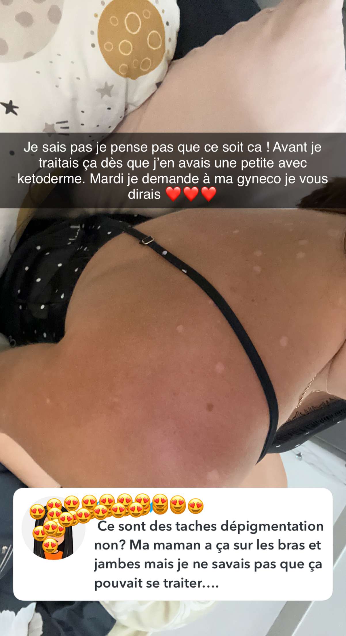 Story