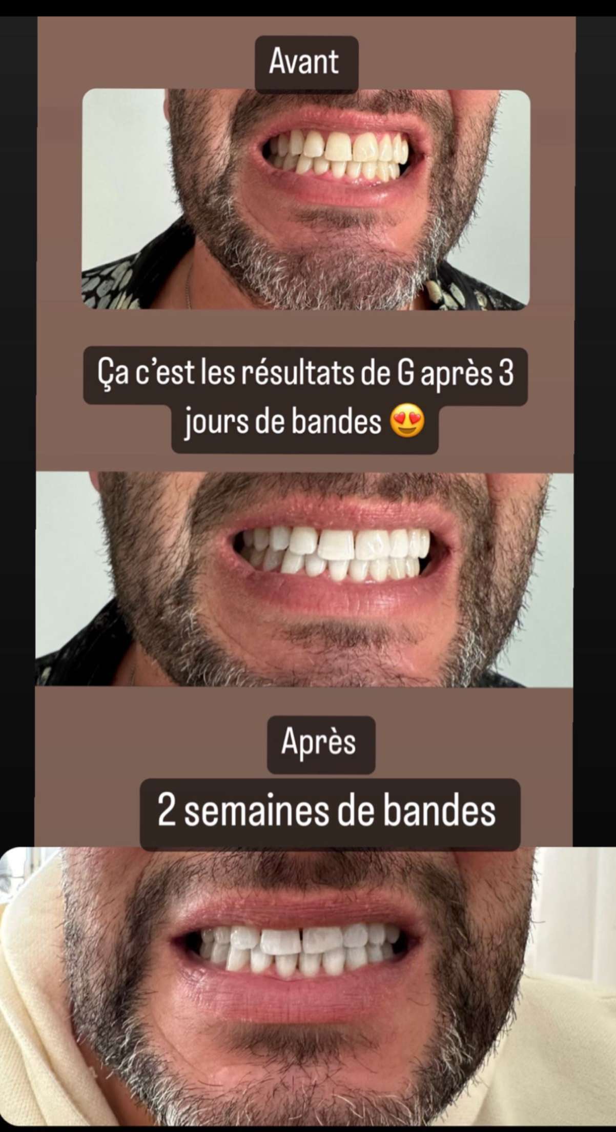 Story
