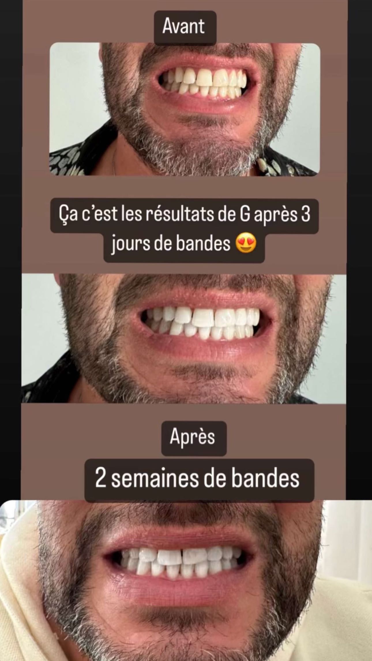 Story