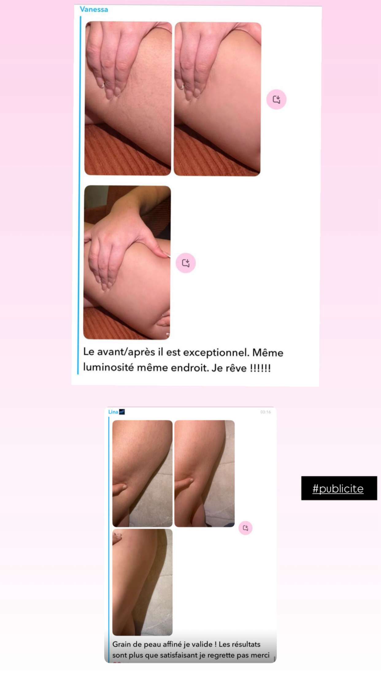 Story